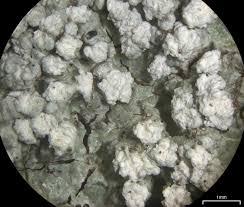 Attēlu rezultāti vaicājumam “Pertusaria amara”