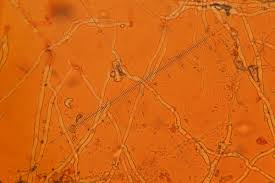 Attēlu rezultāti vaicājumam “Erysiphe galeopsidis”