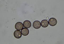 Attēlu rezultāti vaicājumam “Diderma montanum var. album spores”