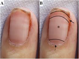 Image result for lunula nail