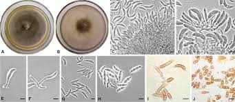 Attēlu rezultāti vaicājumam “Stemonitopsis aequalis var. microspora stalked”