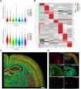 Improved in situ sequencing for high-resolution targeted spatial ...