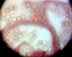 Attēlu rezultāti vaicājumam “Cribraria rubiginosa”