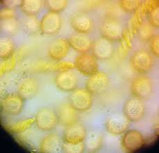 Attēlu rezultāti vaicājumam “Hemitrichia leiotricha spores”