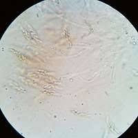 Attēlu rezultāti vaicājumam “Melanospora lagenaria”