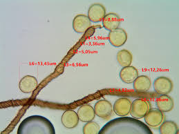 Attēlu rezultāti vaicājumam “Trichia contorta sessile”