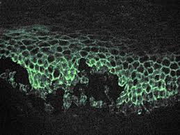 Attēlu rezultāti vaicājumam “Pemphigus borealis”