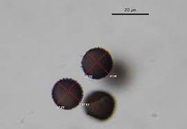 Attēlu rezultāti vaicājumam “Lamproderma pseudomaculatum spores”