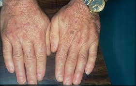 Image result for Lewandowsky-Lutz