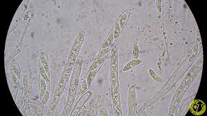 Attēlu rezultāti vaicājumam “Rutstroemia firma”