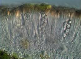 Attēlu rezultāti vaicājumam “Lecanora argentata”