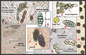 Attēlu rezultāti vaicājumam “Lignydium muscorum spores”