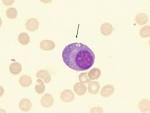 <b>Plasma cells</b>