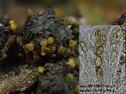 Attēlu rezultāti vaicājumam “Ombrophila violacea spores”