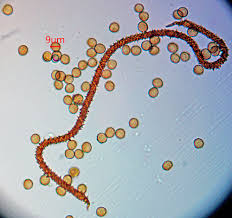 Attēlu rezultāti vaicājumam “Ophiotheca sp.”