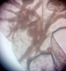 Attēlu rezultāti vaicājumam “Badhamiopsis scripta”