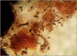 Attēlu rezultāti vaicājumam “Hypoxylon fragiforme / howeianum”