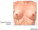 nipples