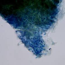 Attēlu rezultāti vaicājumam “Microcalicium disseminatum”