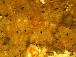 Attēlu rezultāti vaicājumam “Rhytisma acerinum”