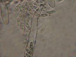 Attēlu rezultāti vaicājumam “Hyaloscypha hyalina”