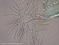 Attēlu rezultāti vaicājumam “Hypocrea rufa”