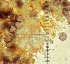Attēlu rezultāti vaicājumam “Didymium tussilaginis spores”