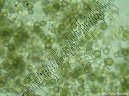 Attēlu rezultāti vaicājumam “Chaenotheca stemonea”