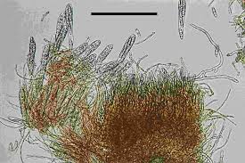 Attēlu rezultāti vaicājumam “Octosporella jungermanniarum”