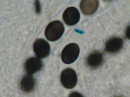 Attēlu rezultāti vaicājumam “Biscogniauxia marginata”