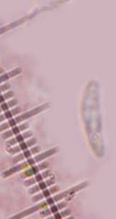 Attēlu rezultāti vaicājumam “Hyaloscypha hyalina”