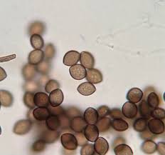 Attēlu rezultāti vaicājumam “Craterium minutum spores”