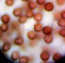 Attēlu rezultāti vaicājumam “Didymium tussilaginis spores”