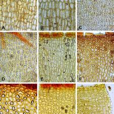 Attēlu rezultāti vaicājumam “Seligeria pusilla sporophyte”