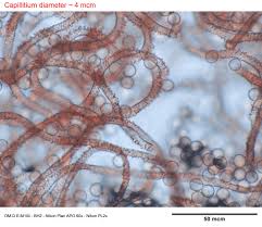 Attēlu rezultāti vaicājumam “Arcyria stipata”