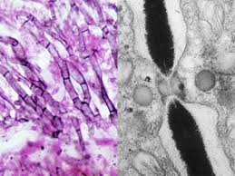 Attēlu rezultāti vaicājumam “Ascomycota”
