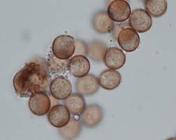 Attēlu rezultāti vaicājumam “Willkommlangea reticulata spores”