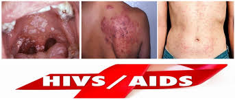 Image result for фотография вируса вич