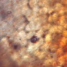 Attēlu rezultāti vaicājumam “Stemonitopsis aequalis (var. aequalis) spores”