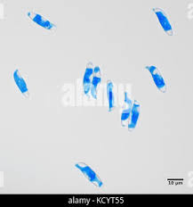 Attēlu rezultāti vaicājumam “Dacrymyces chrysospermus spores”