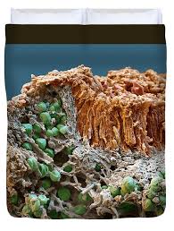 Attēlu rezultāti vaicājumam “Caloplaca saxicola”