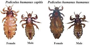 Attēlu rezultāti vaicājumam “Pediculus humanus capitis”