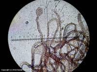 Attēlu rezultāti vaicājumam “Arcyria stipata spores”