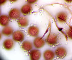 Attēlu rezultāti vaicājumam “Diderma subviridifuscum”