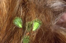 Attēlu rezultāti vaicājumam “Agrimonia eupatoria fruit”