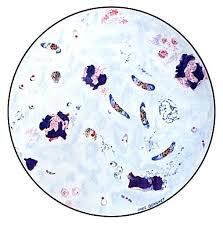 Attēlu rezultāti vaicājumam “Enteridium variabile plasmodium”