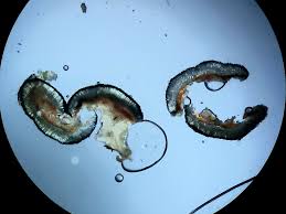 Attēlu rezultāti vaicājumam “Mycoblastus sanguinarius”