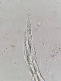 Attēlu rezultāti vaicājumam “Ombrophila violacea spores”