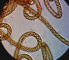 Attēlu rezultāti vaicājumam “Trichiaceae, Hemitrichiaceae, Arcyriaceae”