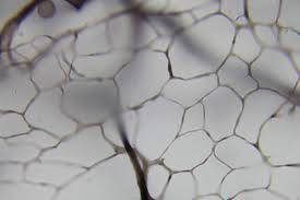 Attēlu rezultāti vaicājumam “Stemonaria irregularis spores”